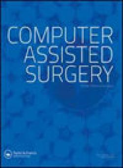 Computer Assisted Surgery